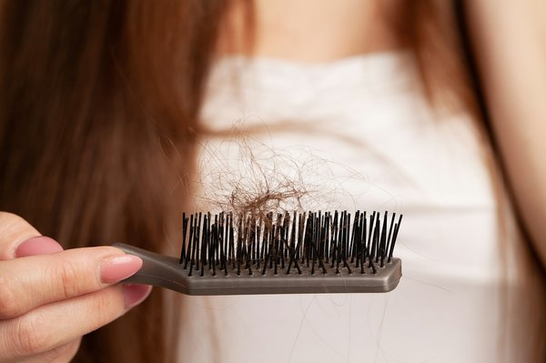 Astuces contre la perte de cheveux : retrouvez votre confiance !